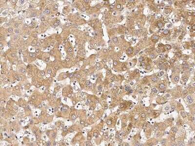 Immunohistochemistry-Paraffin: IBRDC1 Antibody [NBP2-99001] - Immunochemical staining of human IBRDC1 in human liver with rabbit polyclonal antibody (1:1000, formalin-fixed paraffin embedded sections).