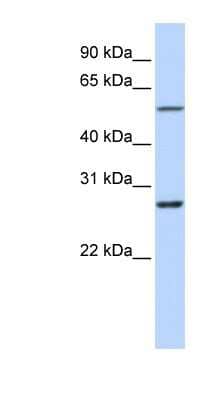 Western Blot: IBRDC1 Antibody [NBP1-59776] - Human Heart lysate, concentration 0.2-1 ug/ml.