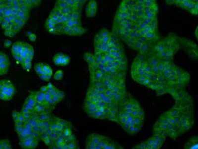 Immunocytochemistry/Immunofluorescence: IBRDC2 Antibody (9H10) [NBP2-02128] - Immunofluorescent staining of HeLa cells using anti-IBRDC2 mouse monoclonal antibody.