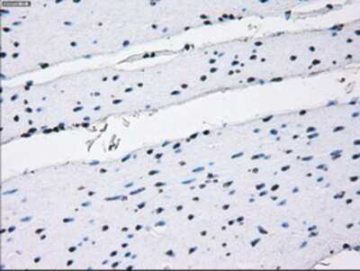 Immunohistochemistry-Paraffin: IBRDC2 Antibody (9H10) [NBP2-02128] - Staining of paraffin-embedded Human colon tissue using anti-IBRDC2 mouse monoclonal antibody.