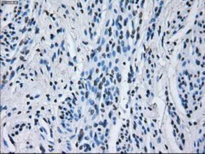 Immunohistochemistry-Paraffin: IBRDC2 Antibody (9H10) [NBP2-02128] - Staining of paraffin-embedded Human endometrium tissue using anti-IBRDC2 mouse monoclonal antibody.