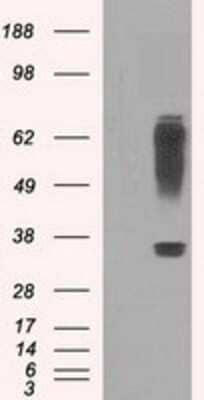 Western Blot: IBRDC2 Antibody (9H10) [NBP2-02128] - HEK293T cells were transfected with the pCMV6-ENTRY control (Left lane) or pCMV6-ENTRY IBRDC2 (Right lane) cDNA for 48 hrs and lysed. Equivalent amounts of cell lysates (5 ug per lane) were separated by SDS-PAGE and immunoblotted with anti-IBRDC2.