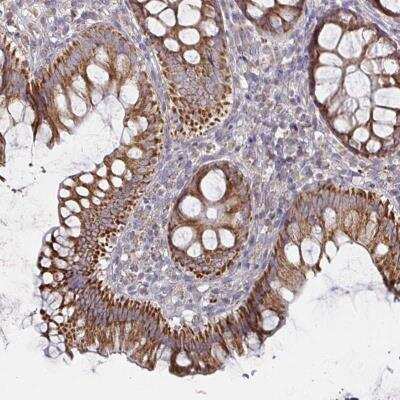 Immunohistochemistry-Paraffin: IBRDC2 Antibody [NBP2-37941] - Staining of human colon shows strong cytoplasmic positivity in glandular cells.