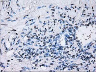 Immunohistochemistry: IBRDC2 Antibody (OTI9H10) - Azide and BSA Free [NBP2-72470] - Staining of paraffin-embedded Human prostate tissue using anti-IBRDC2 mouse monoclonal antibody.