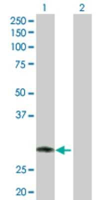 Western Blot: IBRDC2 Antibody [H00255488-D01P] - Analysis of RNF144B expression in transfected 293T cell line by RNF144B polyclonal antibody.Lane 1: RNF144B transfected lysate(33.60 KDa).Lane 2: Non-transfected lysate.