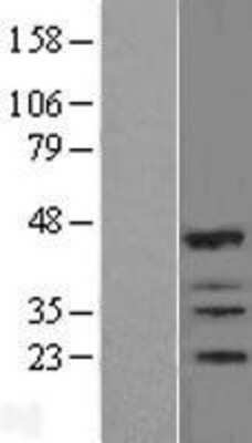 Western Blot: IBRDC2 Overexpression Lysate (Adult Normal) [NBL1-15428] Left-Empty vector transfected control cell lysate (HEK293 cell lysate); Right -Over-expression Lysate for IBRDC2.