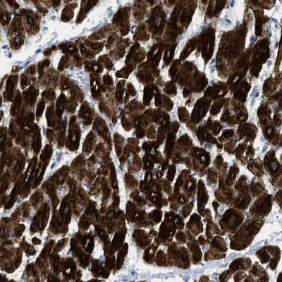 Immunohistochemistry-Paraffin: ICA1 Antibody [NBP1-83124] - Staining of human heart muscle shows strong cytoplasmic positivity in myocytes.