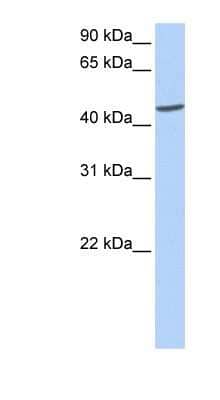 Western Blot: ICA1 Antibody [NBP1-55450] - Human Muscle lysate, concentration 0.2-1 ug/ml.