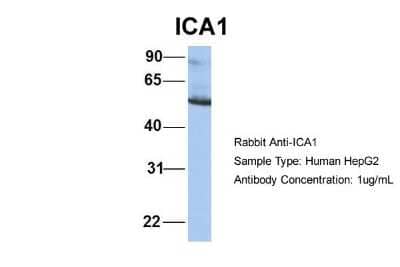 Western Blot: ICA1 Antibody [NBP1-56426] - Human HepG2, Antibody Dilution: 1.0 ug/ml There is BioGPS gene expression data showing that ICA1 is expressed in HepG2.