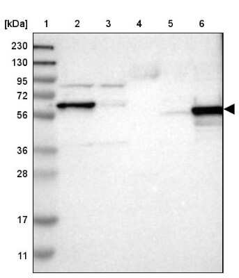 Western Blot: ICA1 Antibody [NBP1-83124] - Lane 1: Marker  [kDa] 230, 130, 95, 72, 56, 36, 28, 17, 11.  Lane 2: Human cell line RT-4.  Lane 3: Human cell line U-251MG sp.  Lane 4: Human plasma (IgG/HSA depleted).  Lane 5: Human liver tissue.  Lane 6: Human tonsil tissue