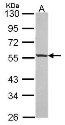 Western Blot: ICA1 Antibody [NBP2-16909] - Sample (30 ug of whole cell lysate) A: A549 10% SDS PAGE gel, diluted at 1:1000.