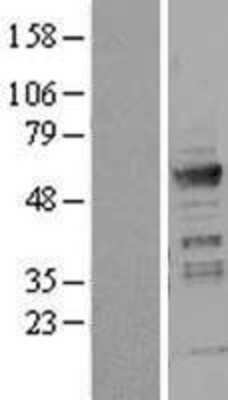 Western Blot: ICA1 Overexpression Lysate (Adult Normal) [NBL1-11801] Left-Empty vector transfected control cell lysate (HEK293 cell lysate); Right -Over-expression Lysate for ICA1.