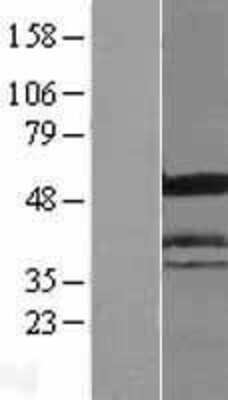 Western Blot: ICA1 Overexpression Lysate (Adult Normal) [NBL1-11802] Left-Empty vector transfected control cell lysate (HEK293 cell lysate); Right -Over-expression Lysate for ICA1.