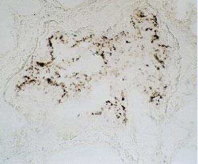 Immunohistochemistry-Paraffin: ICAM-1/CD54 Antibody (117G12.02) [DDX0150P-100] - Lung