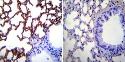 Immunohistochemistry-Paraffin: ICAM-1/CD54 Antibody (3E2B) [NBP2-22540] - Normal biopsies of deparaffinized Mouse lung tissue.