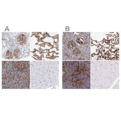 <b>Independent Antibodies Validation and Orthogonal Strategies Validation.</b>Immunohistochemistry-Paraffin: ICAM-1/CD54 Antibody [NBP1-88700] - Staining of human kidney, lung, lymph node and skeletal muscle using Anti-ICAM1 antibody NBP1-88700 (A) shows similar protein distribution across tissues to independent antibody NBP1-88701 (B).