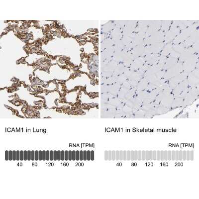 Immunohistochemistry-Paraffin: ICAM-1/CD54 Antibody [NBP1-88700] - Analysis in human lung and skeletal muscle tissues. Corresponding ICAM1 RNA-seq data are presented for the same tissues.