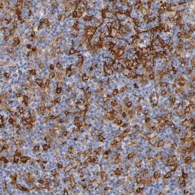 Immunohistochemistry-Paraffin: ICAM-1/CD54 Antibody [NBP1-88700] - Staining of human lymph node shows moderate membranous positivity.