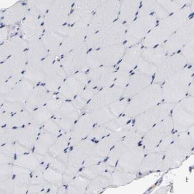 Immunohistochemistry-Paraffin: ICAM-1/CD54 Antibody [NBP1-88700] - Staining of human skeletal muscle shows no positivity in myocytes as expected.