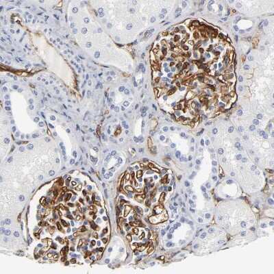 Immunohistochemistry-Paraffin: ICAM-1/CD54 Antibody [NBP1-88700] - Staining of human kidney shows moderate membranous positivity in cells in glomeruli.