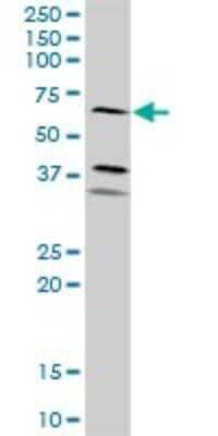 Western Blot: ICAM-1/CD54 Antibody [H00003383-D01P] - Analysis of ICAM1 expression in mouse liver.