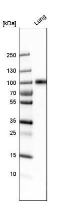 Western Blot: ICAM-1/CD54 Antibody [NBP1-88700] - Analysis in human lung tissue.