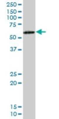 Western Blot: ICAM-2/CD102 Antibody [H00003384-B01P] - Analysis of ICAM2 expression in human spleen.