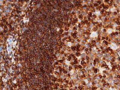 Immunohistochemistry-Paraffin: ICAM-3/CD50 Antibody (002) [NBP2-89426] - Staining of human ICAM3 in human tonsil with rabbit monoclonal antibody (1:200).