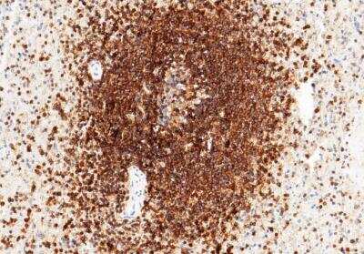 Immunohistochemistry-Paraffin: ICAM-3/CD50 Antibody (002) [NBP2-89426] - Staining of human ICAM3 in human spleen with rabbit monoclonal antibody (1:200).