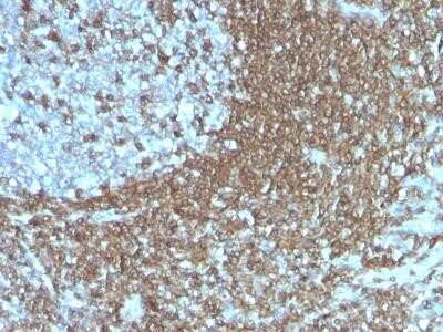 Immunohistochemistry-Paraffin: ICAM-3/CD50 Antibody (186-2G9) - Azide and BSA Free [NBP2-34521] - Formalin-fixed, paraffin-embedded human Tonsil stained with CD50 Monoclonal Antibody (186-2G9).