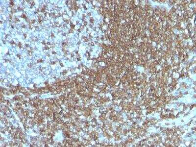Immunohistochemistry-Paraffin: ICAM-3/CD50 Antibody (186-2G9) [NBP2-32941] - Formalin-fixed, paraffin-embedded human Tonsil stained with CD50 Monoclonal Antibody (186-2G9).
