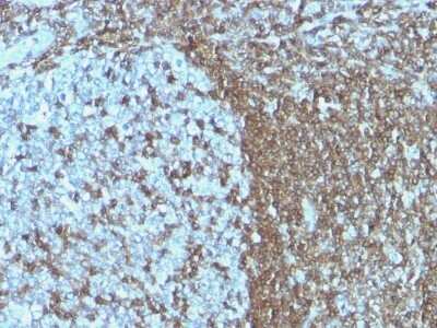 Immunohistochemistry-Paraffin: ICAM-3/CD50 Antibody (ICAM3/1019) - Azide and BSA Free [NBP2-47903] - Human Tonsil stained with CD50 Monoclonal Antibody (ICAM3/1019)