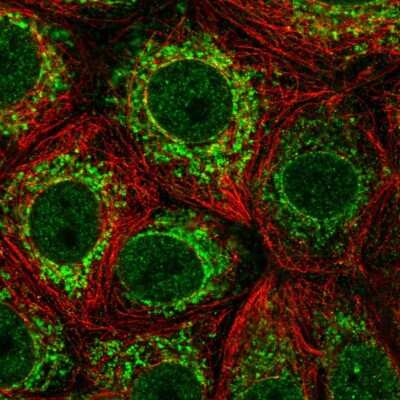 Immunocytochemistry/Immunofluorescence: ICAM-3/CD50 Antibody [NBP2-57135] - Staining of human cell line MCF7 shows localization to nucleoplasm, nuclear membrane & mitochondria.