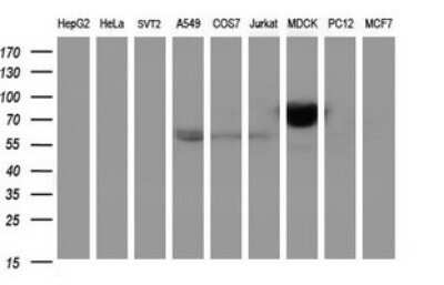 Western Blot: ICAM-3/CD50 Antibody (OTI1E7) - Azide and BSA Free [NBP2-70975] - Analysis of extracts (35ug) from 9 different cell lines by using ICAM3 monoclonal antibody (HepG2: human; HeLa: human; SVT2: mouse; A549: human; COS7: monkey; Jurkat: human; MDCK: canine; PC12: rat; MCF7: human).