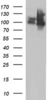 Western Blot: ICAM-3/CD50 Antibody (OTI1E7) - Azide and BSA Free [NBP2-70975] - Analysis of HEK293T cells were transfected with the pCMV6-ENTRY control (Left lane) or pCMV6-ENTRY ICAM-3.