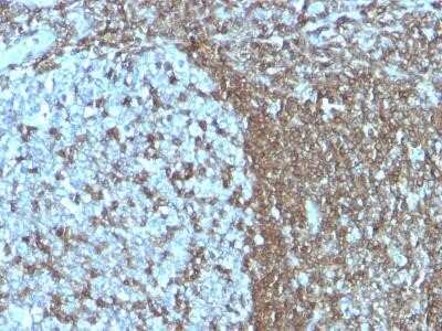 Immunohistochemistry-Paraffin: ICAM-3/CD50 Antibody (SPM505) - Azide and BSA Free [NBP2-34776] - Formalin-fixed, paraffin-embedded human Tonsil stained with CD50 Monoclonal Antibody (SPM505).