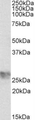 Western Blot: ICAM-4 Antibody [NBP2-26177] - Staining of Human Umbillical Cord lysate (35 ug protein in RIPA buffer). Primary incubation was 1 hour. Detected by chemiluminescence.  