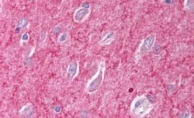 Immunohistochemistry-Paraffin: ICAM-5 Antibody [NB100-53815] - Analysis of ICAM5 precursor in paraffin-embedded Human Brain (Cerebral Cortex) using this antibody at 2.5 ug/ml. Steamed antigen retrieval with citrate buffer pH 6, AP-staining.