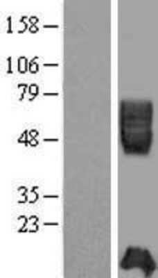 Western Blot: ICAM2 Overexpression Lysate (Adult Normal) [NBP2-09324] Left-Empty vector transfected control cell lysate (HEK293 cell lysate); Right -Over-expression Lysate for ICAM2.