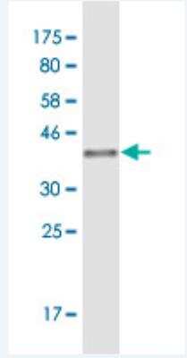 Western Blot: ICAP-1 Antibody (1E7) [H00009270-M08] - Detection against Immunogen (36.74 KDa) .