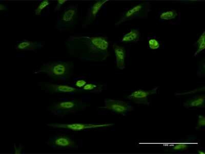 Immunocytochemistry/Immunofluorescence: ICAP-1 Antibody (3B2) [H00009270-M09] - Analysis of monoclonal antibody to ITGB1BP1 on HeLa cell. Antibody concentration 10 ug/ml