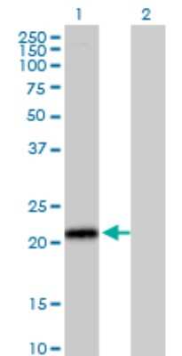 Western Blot: ICAP-1 Antibody (3B2) [H00009270-M09] - Analysis of ITGB1BP1 expression in transfected 293T cell line by ITGB1BP1 monoclonal antibody (M09), clone 3B2. Lane 1: ITGB1BP1 transfected lysatE (21.8 KDa). Lane 2: Non-transfected lysate.