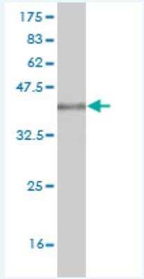 Western Blot: ICAP-1 Antibody (3G4) [H00009270-M04] - Detection against Immunogen (36.74 KDa) .