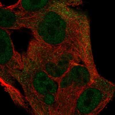 Immunocytochemistry/Immunofluorescence: ICAP-1 Antibody [NBP2-57261] - Staining of human cell line SK-MEL-30 shows localization to nucleoplasm & cytosol.