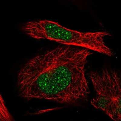 Immunocytochemistry/Immunofluorescence: ICAP-1 Antibody [NBP2-68856] - Staining of human cell line U-251 MG shows localization to nuclear bodies.