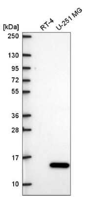 Western Blot: ICAP-1 Antibody [NBP2-57261] - Analysis in human cell line RT-4 and human cell line U-251 MG.