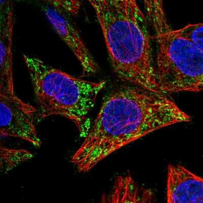 Immunocytochemistry/Immunofluorescence: ICAT/CTNNBIP1 Antibody [NBP2-59020] - Staining of human cell line Hep G2 shows localization to mitochondria.