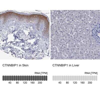 Immunocytochemistry/ Immunofluorescence ICAT/CTNNBIP1 Antibody - BSA Free