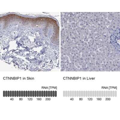 Immunocytochemistry/Immunofluorescence: ICAT/CTNNBIP1 Antibody [NBP3-17057] - Analysis in human skin and liver tissues using Anti-CTNNBIP1 antibody. Corresponding CTNNBIP1 RNA-seq data are presented for the same tissues.