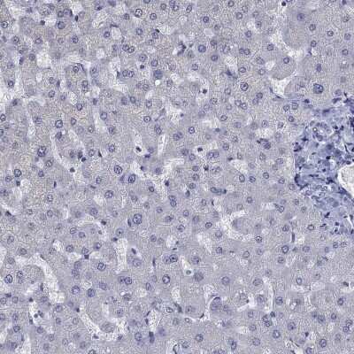 Immunohistochemistry-Paraffin: ICAT/CTNNBIP1 Antibody [NBP3-17057] - Staining of human liver shows low expression as expected.